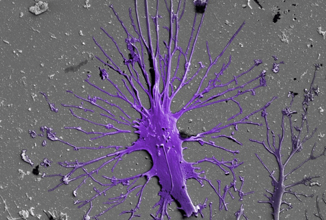 Micrograph of a podocyte